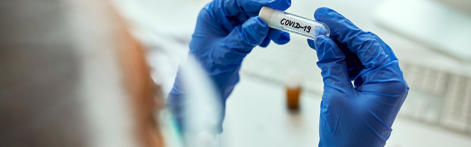 Argos Blog Questions Frequentes Concernant Le Coronavirus Bandeau